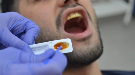 Diş hassasiyeti olanlar için "florsuz vernik" geliştirildi.